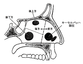 鼻出血のはなし 益田市医師会